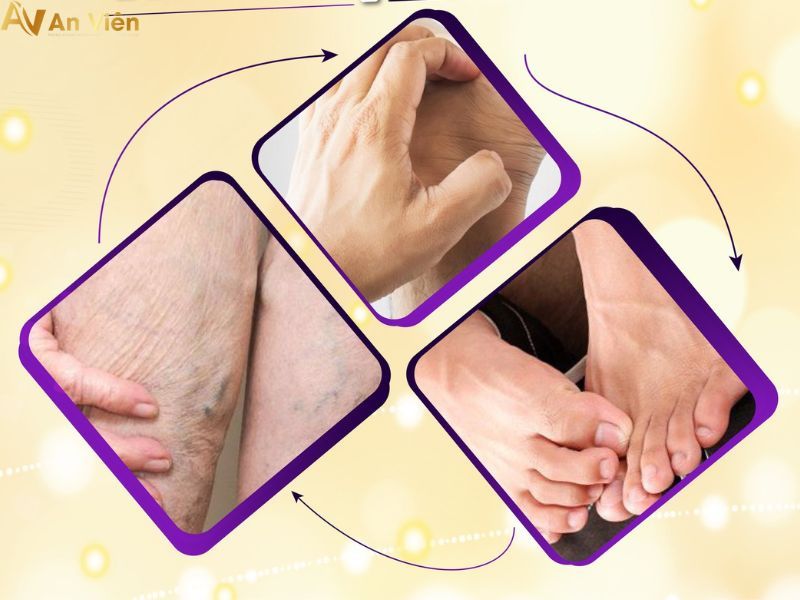 tắc tĩnh mạch chi dưới