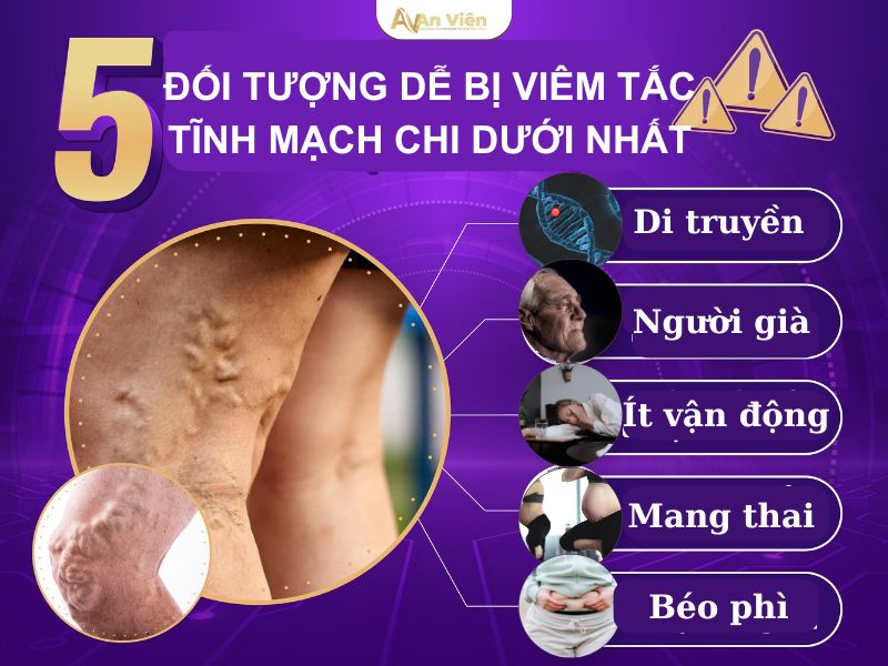 tắc tĩnh mạch chi dưới