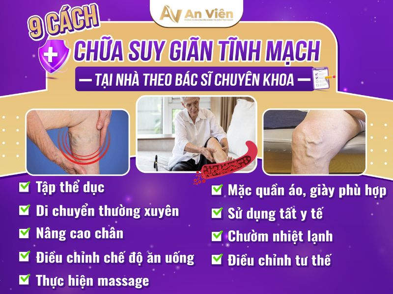 bị giãn tĩnh mạch