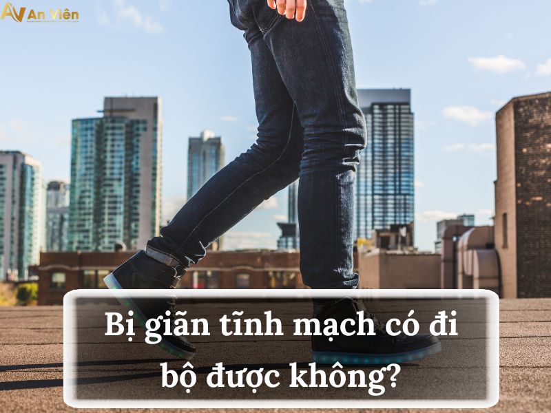 bị giãn tĩnh mạch có đi bộ được không