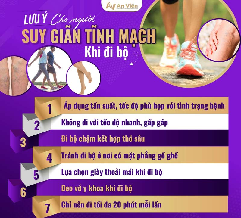 bị giãn tĩnh mạch có đi bộ được không