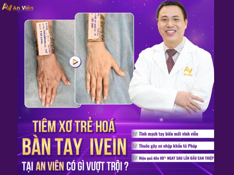 bị nổi gân xanh ở tay