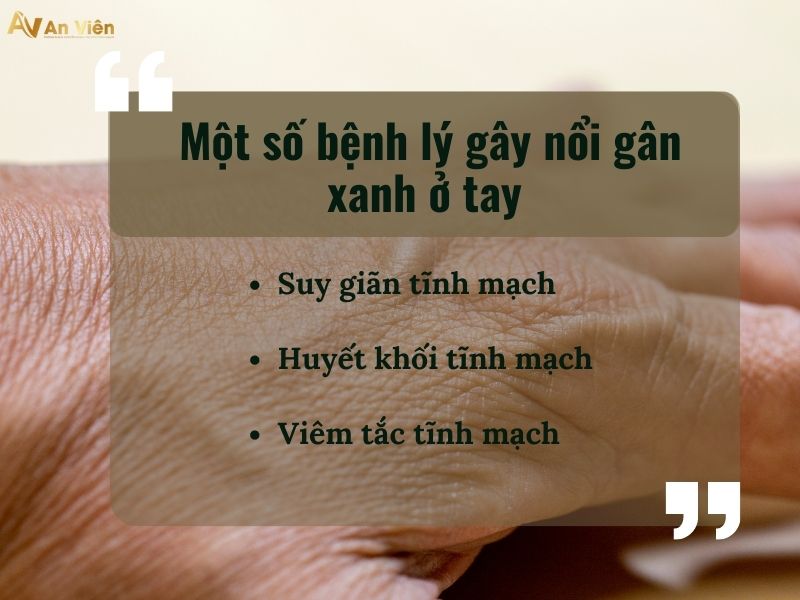 bị nổi gân xanh ở tay