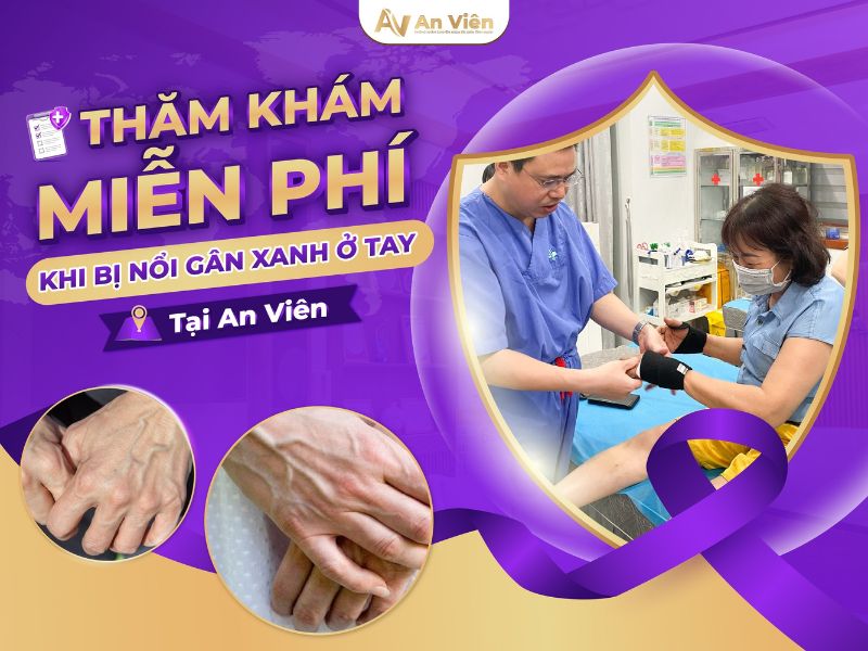 bị nổi gân xanh ở tay