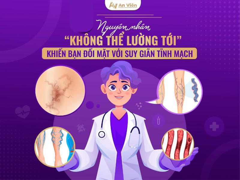 bị tĩnh mạch