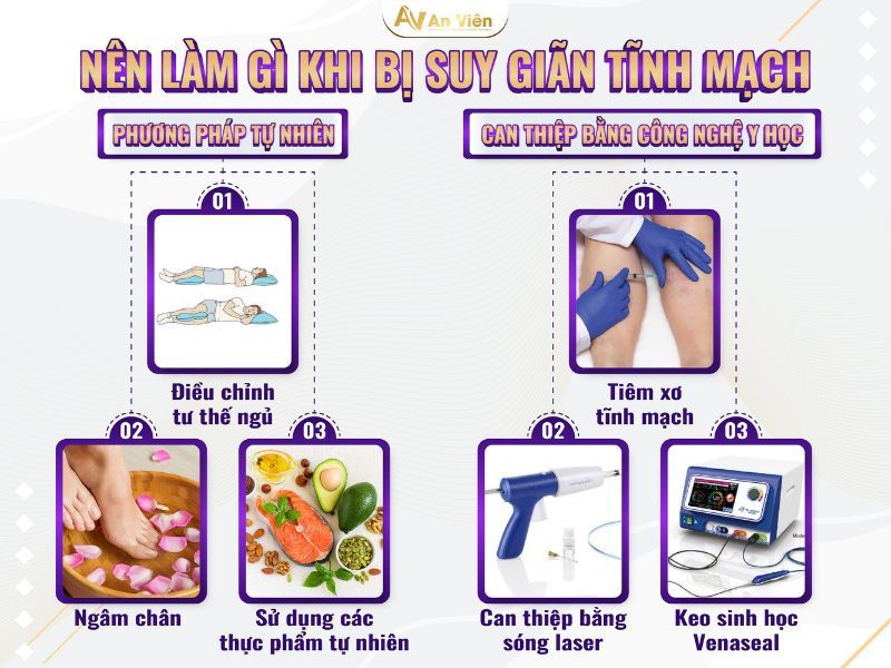 bị tĩnh mạch