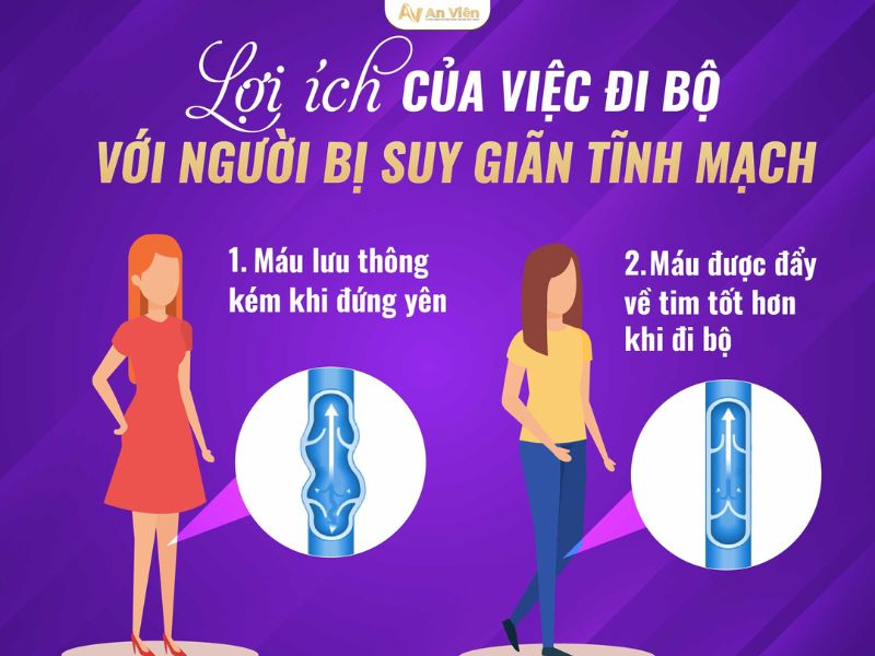 bị tĩnh mạch