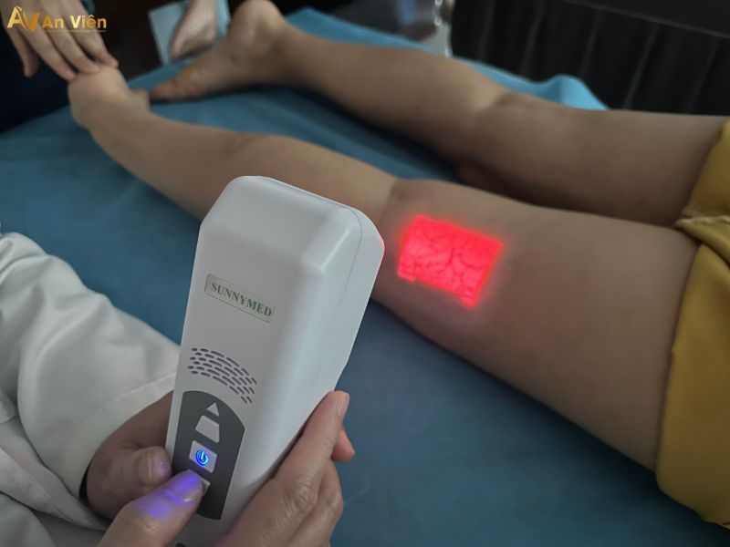 cách chữa bệnh giãn tĩnh mạch