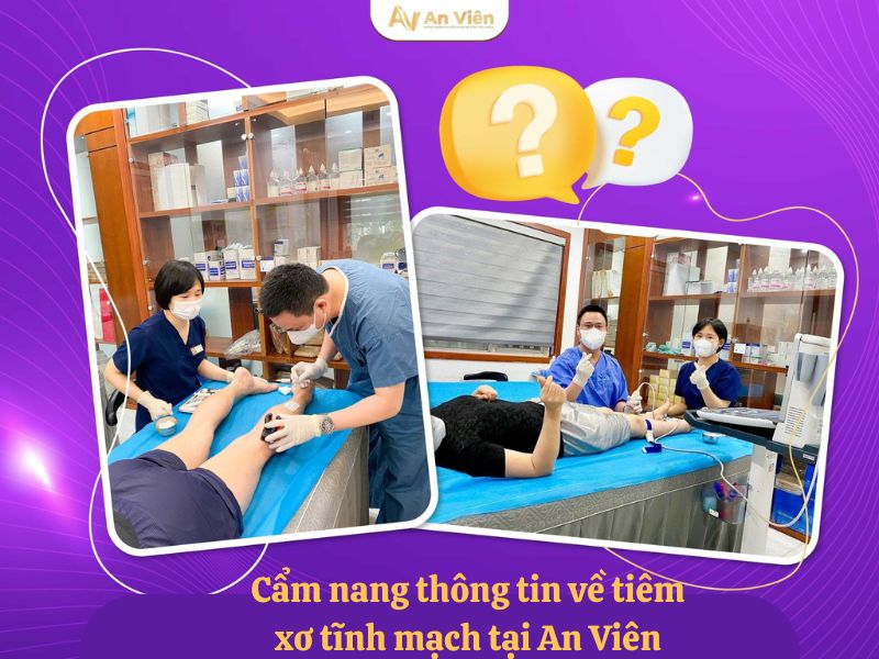 cách chữa bệnh giãn tĩnh mạch