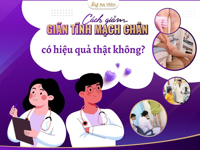 cách giảm suy giãn tĩnh mạch