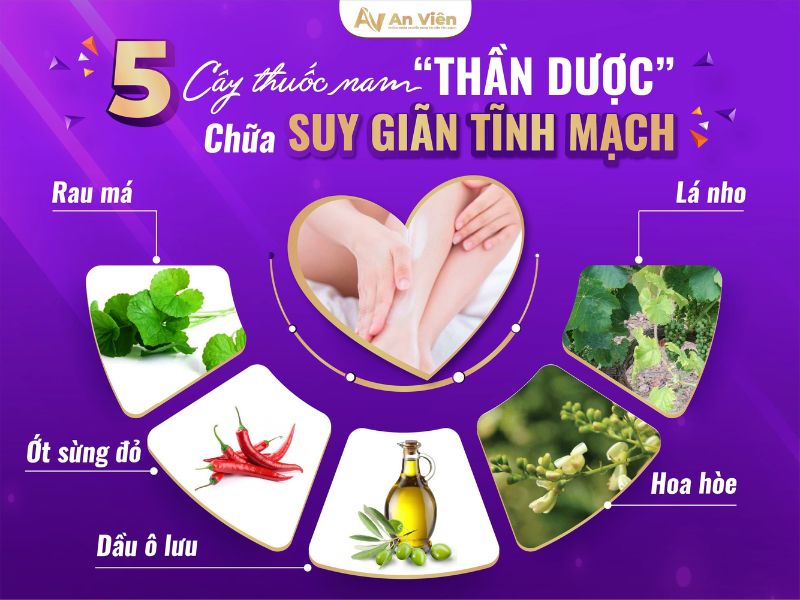 chữa giãn tĩnh mạch