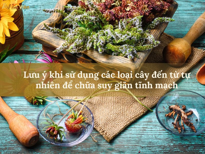 chữa suy giãn tĩnh mạch