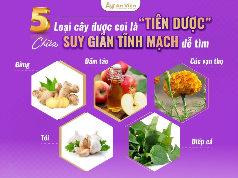 chữa suy giãn tĩnh mạch
