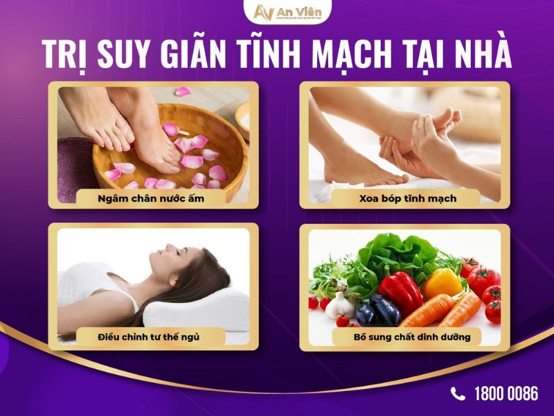 điều trị suy giãn tĩnh mạch chân