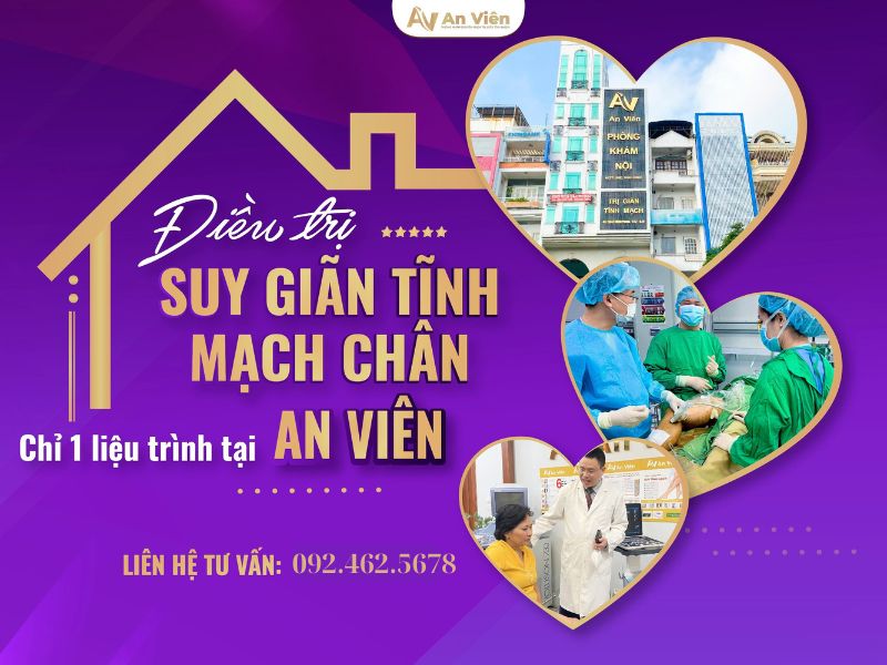 điều trị suy giãn tĩnh mạch chân