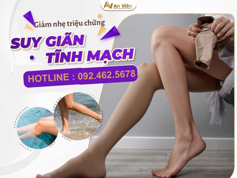 giãn tĩnh mạch cổ chân