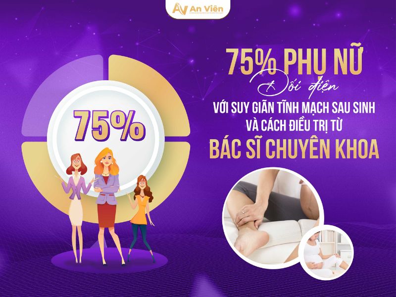 giãn tĩnh mạch là gì