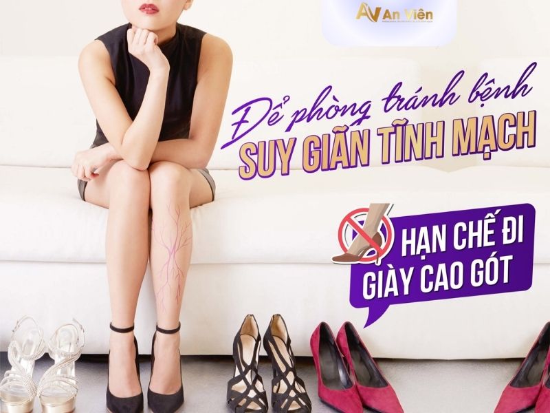 giãn tĩnh mạch là gì