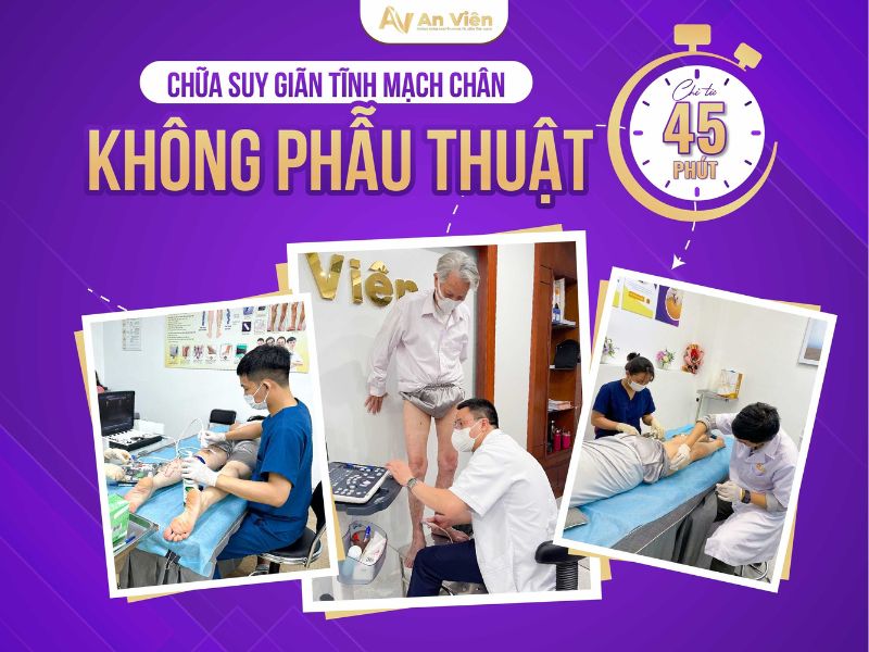 Giãn tĩnh mạch phải làm sao