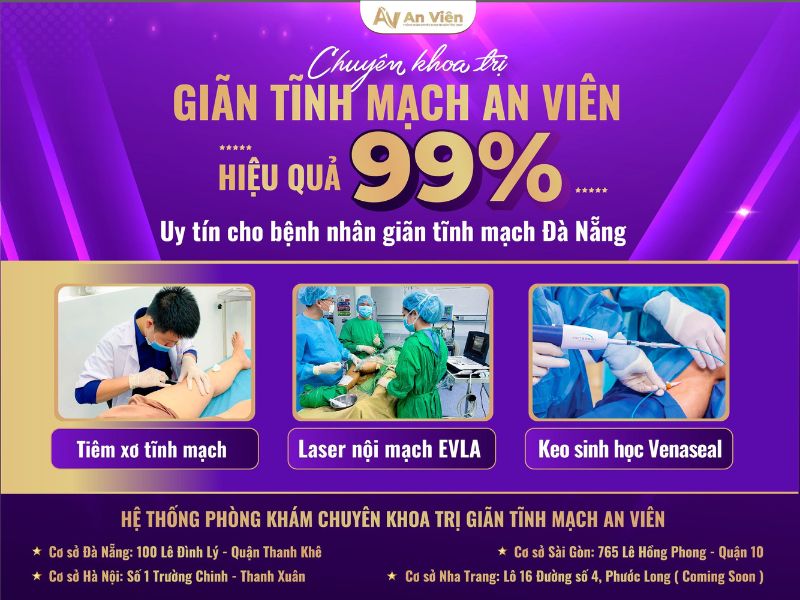 tìm hiểu về bệnh suy giãn tĩnh mạch