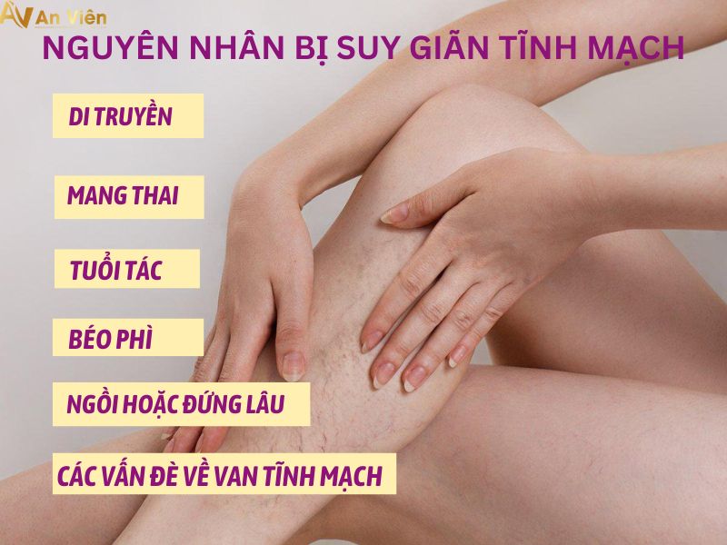 Bài tập trị suy giãn tĩnh mạch