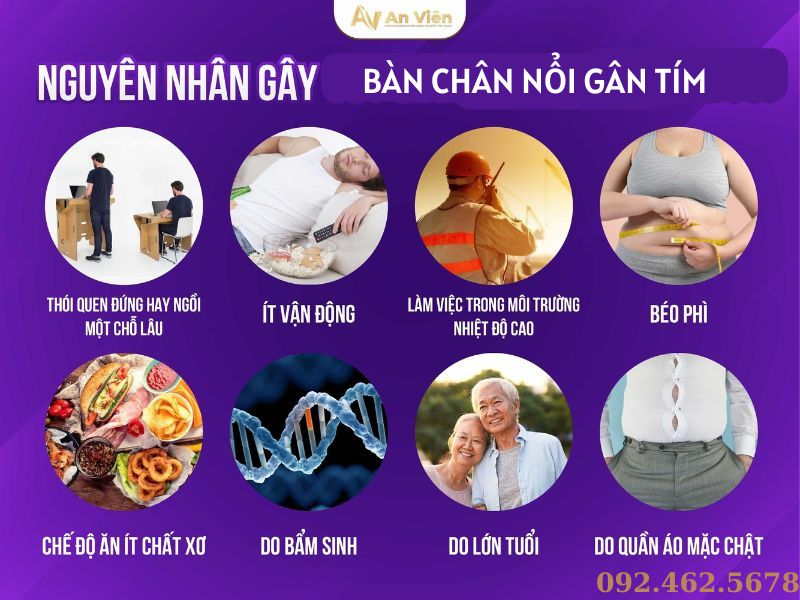 bàn chân nổi gân tím