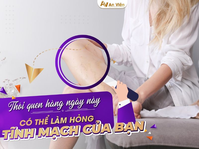 bệnh giãn tĩnh mạch ở chân