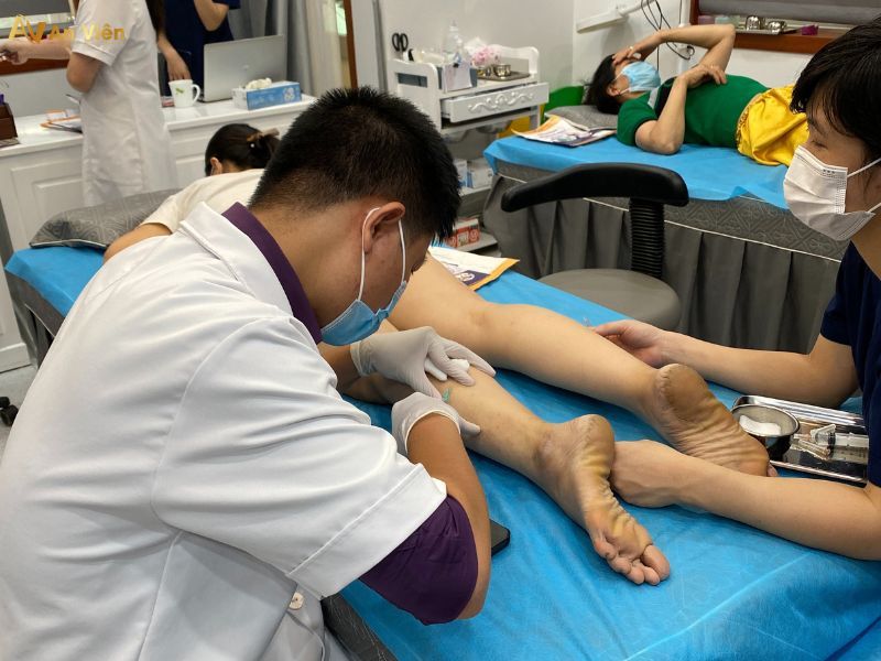 Bệnh suy giãn tĩnh mạch