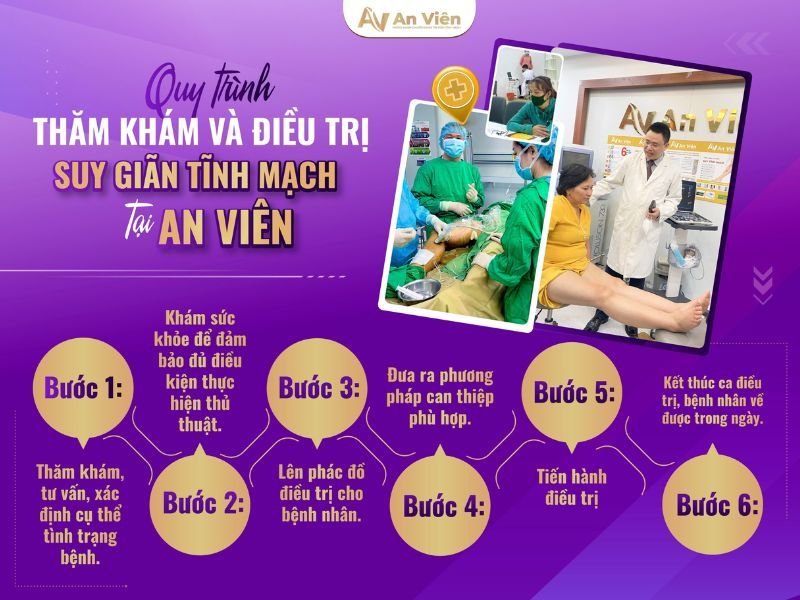 Bệnh suy giãn tĩnh mạch