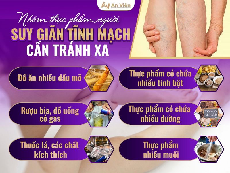 bi gian tinh mach