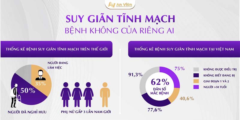 dấu hiệu của suy giãn tĩnh mạch 1