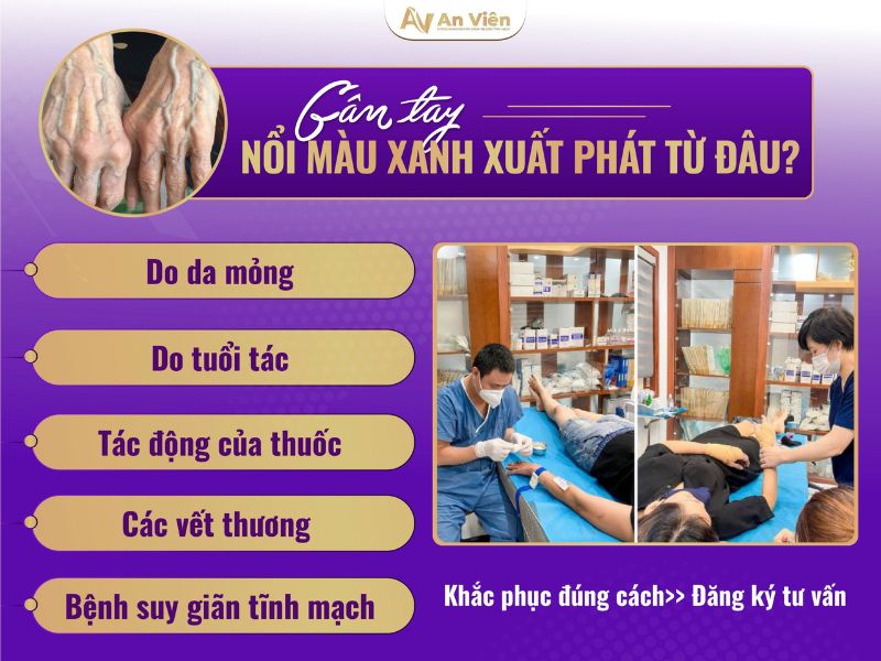 gân tay nổi nhiều phải làm sao