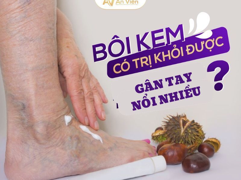 gân tay nổi nhiều phải làm sao