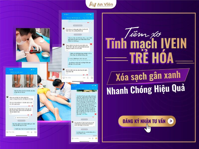 gân tay nổi nhiều phải làm sao
