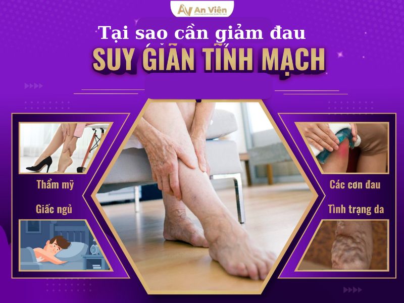 giảm đau giãn tĩnh mạch