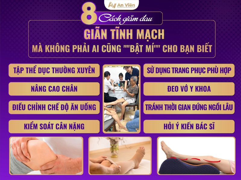 giảm đau giãn tĩnh mạch