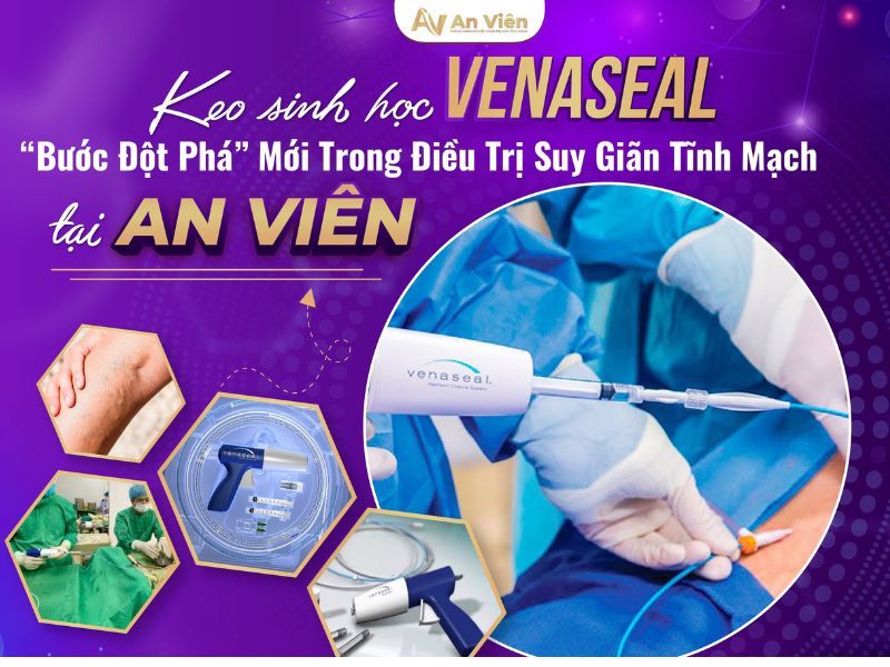 giảm đau giãn tĩnh mạch