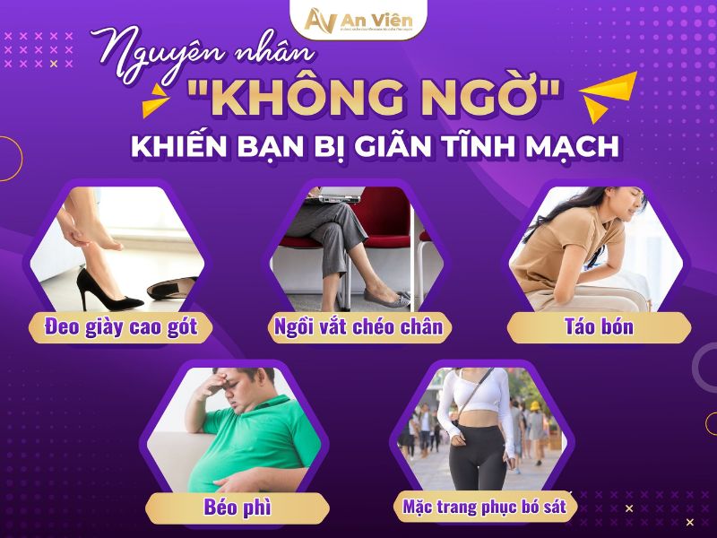 giãn tĩnh mạch chữa như thế nào