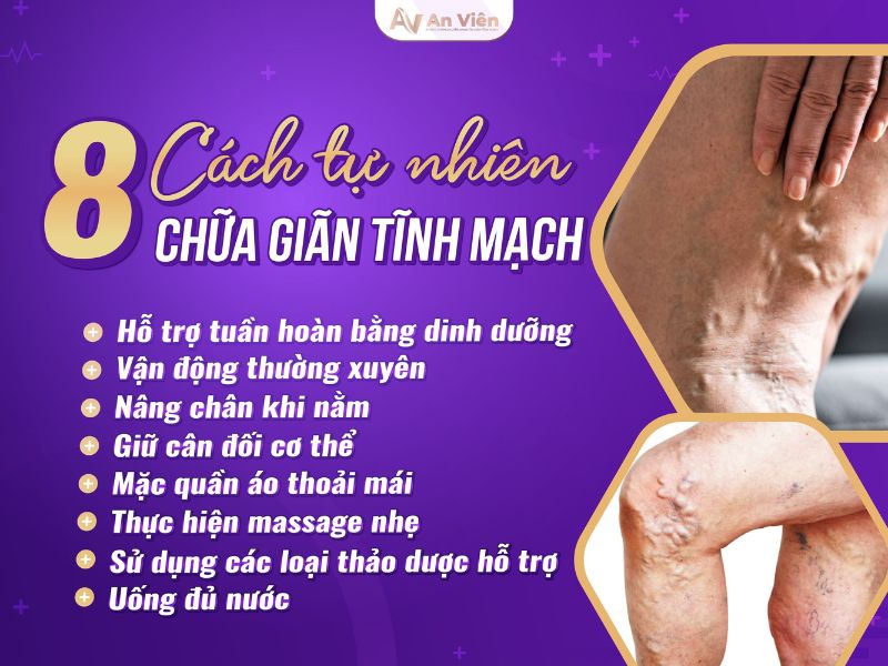 giãn tĩnh mạch nhẹ
