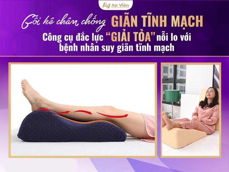 giãn tĩnh mạch nhẹ
