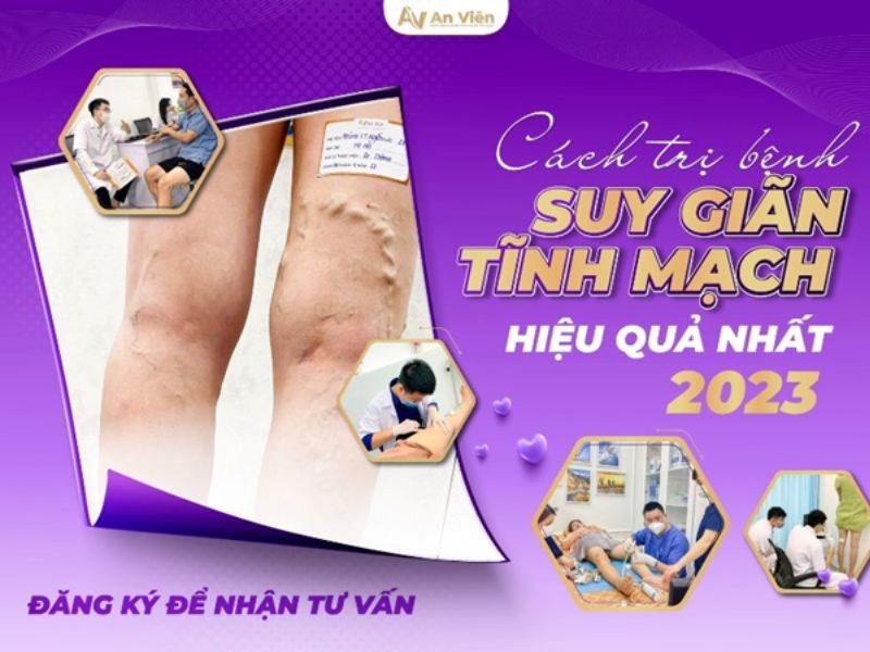 Phòng khám tĩnh mạch An Viên