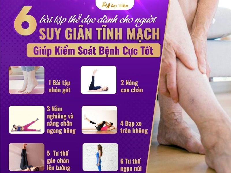tập thể dục suy giãn tĩnh mạch