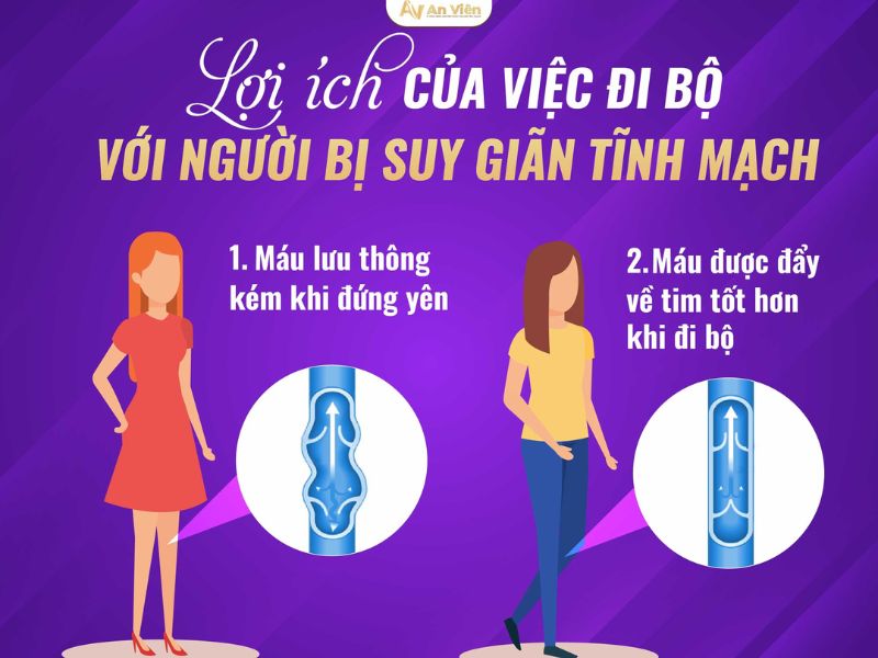 tập thể dục suy giãn tĩnh mạch
