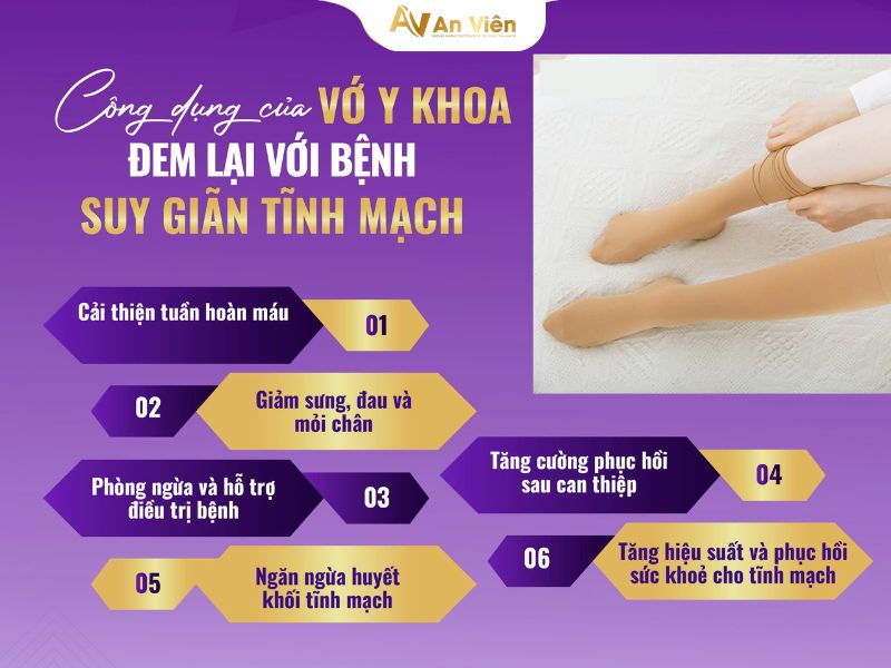 vớ suy giãn tĩnh mạch của nhật