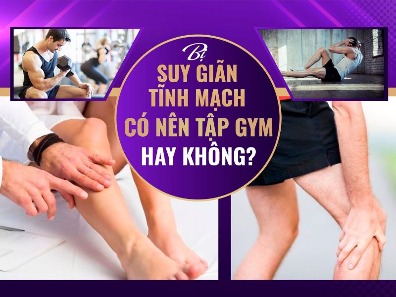 bị giãn tĩnh mạch có được tập aerobic không