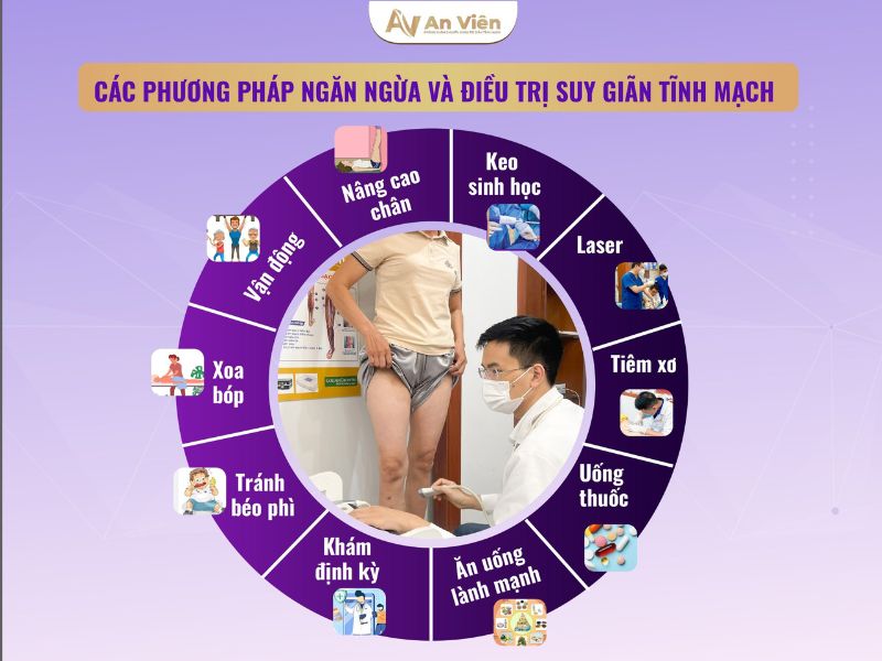 cách chữa trị bệnh giãn tĩnh mạch