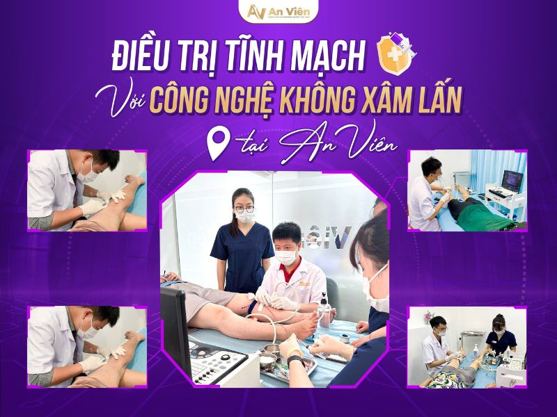 cách điều trị viêm tắc tĩnh mạch chi dưới