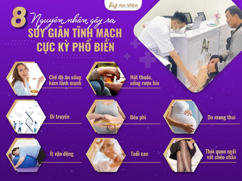 chân bị giãn tĩnh mạch phải làm sao
