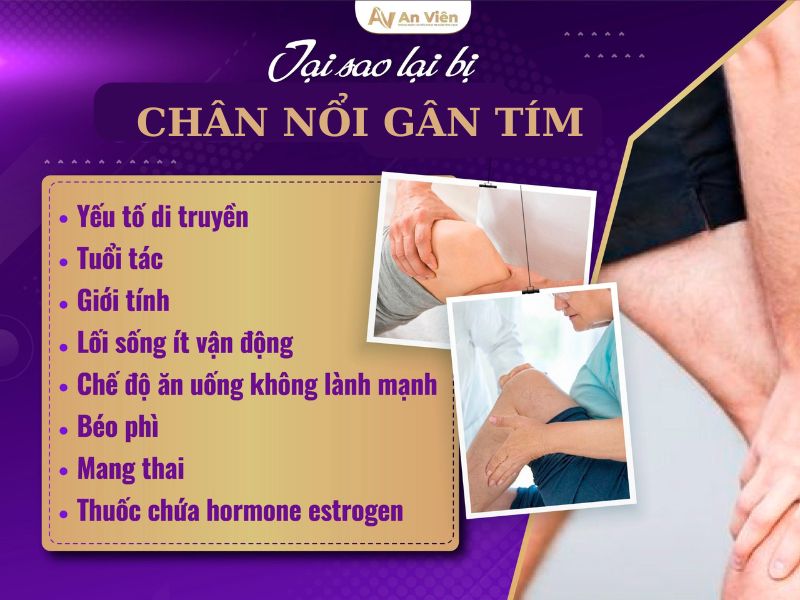 chân nổi gân tím