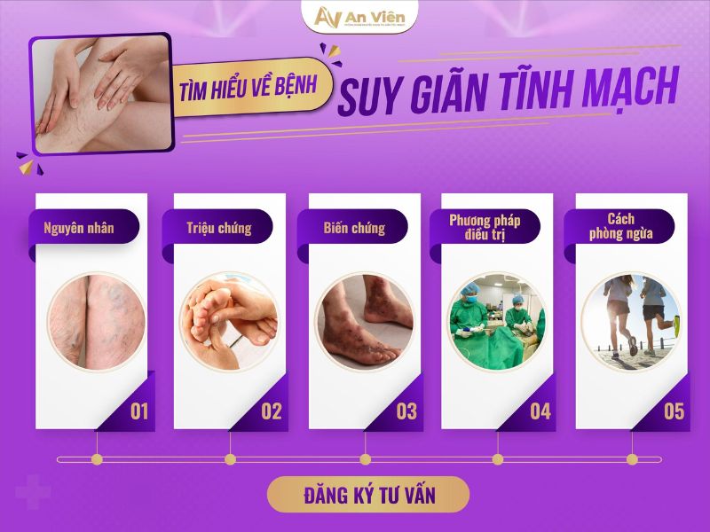 chân nổi gân tím